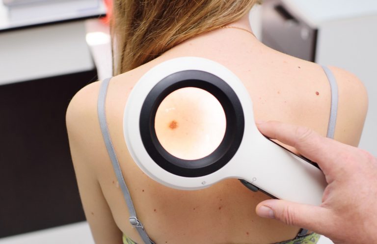 Amor Cantado debate sobre o Câncer de pele