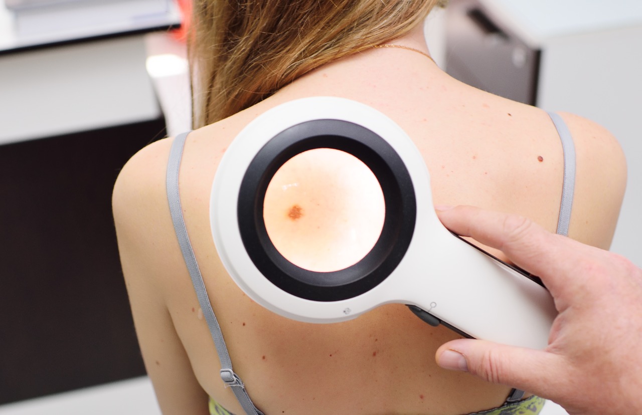 Amor Cantado debate sobre o Câncer de pele