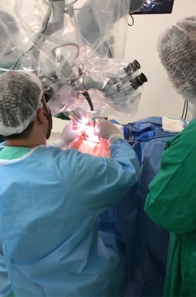 HCN realiza sua primeira cirurgia de clipagem de aneurisma