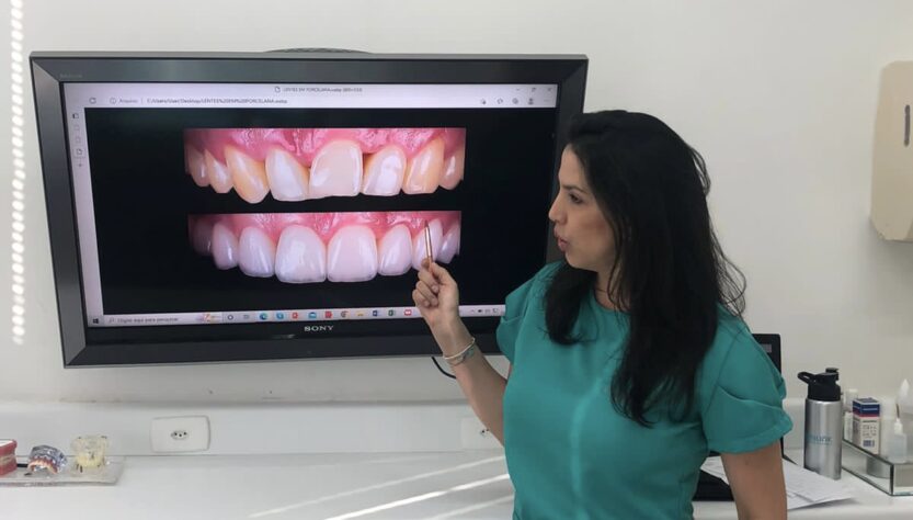 Cirurgiã dentista comenta procedimentos que substituem a tradicional dentadura