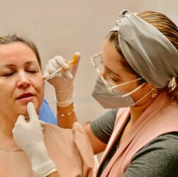 Preenchimento labial: o que é preciso saber antes de fazer