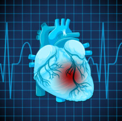 Cardiologista orienta sobre cuidados após o infarto