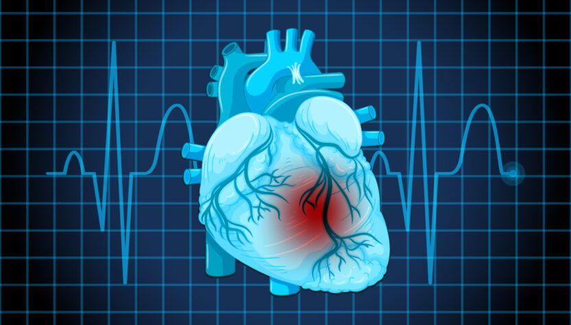 Cardiologista orienta sobre cuidados após o infarto