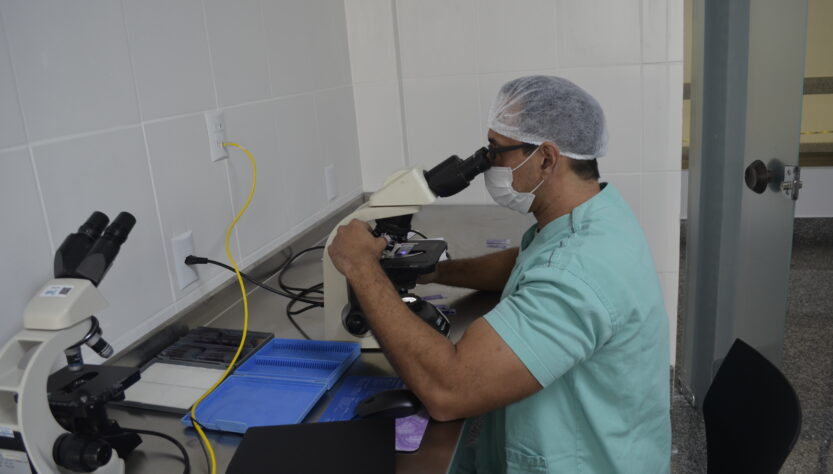 Médico patologista do hospital realizando o procedimento de biópsia por congelação no microscópio