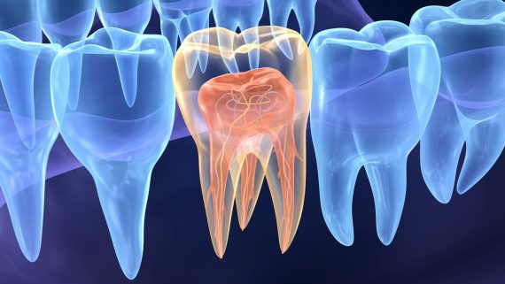 Endodontia ganha espaço na saúde pública nacional