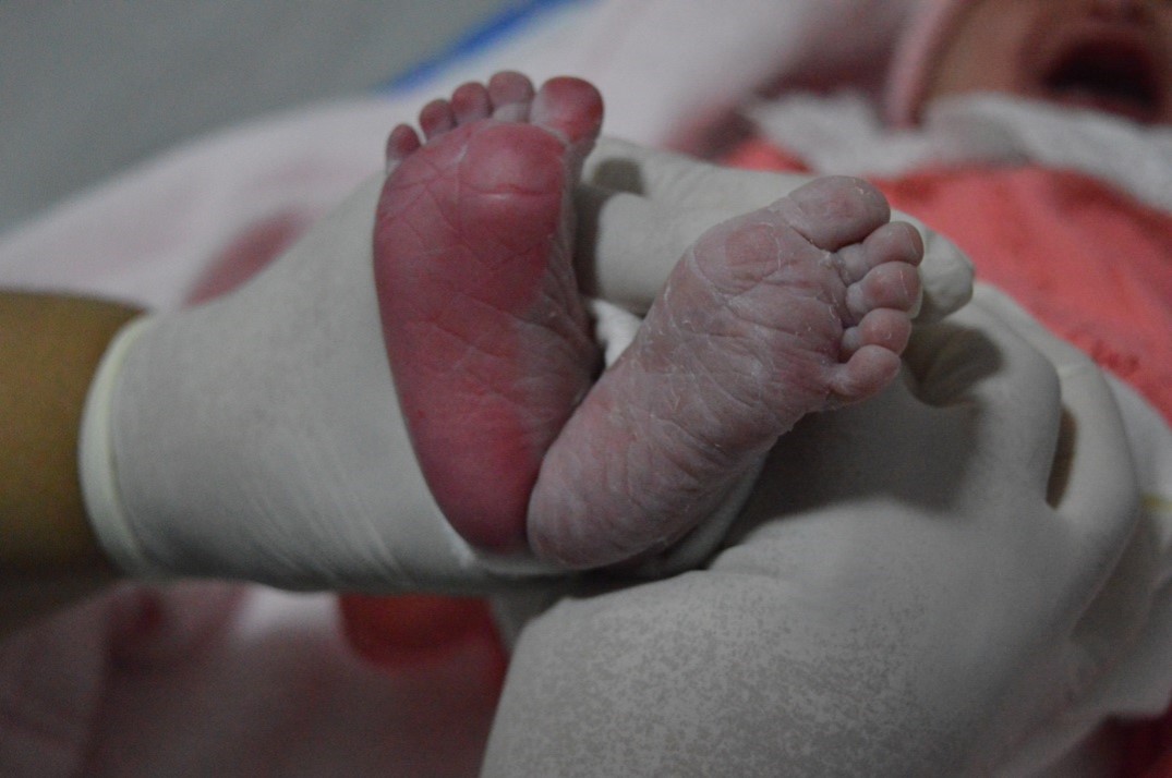 HEF - Hospital Estadual de Formosa proporcionando um ambiente acolhedor para gestantes com o Projeto Acolher, unidade é administrada pelo IMED