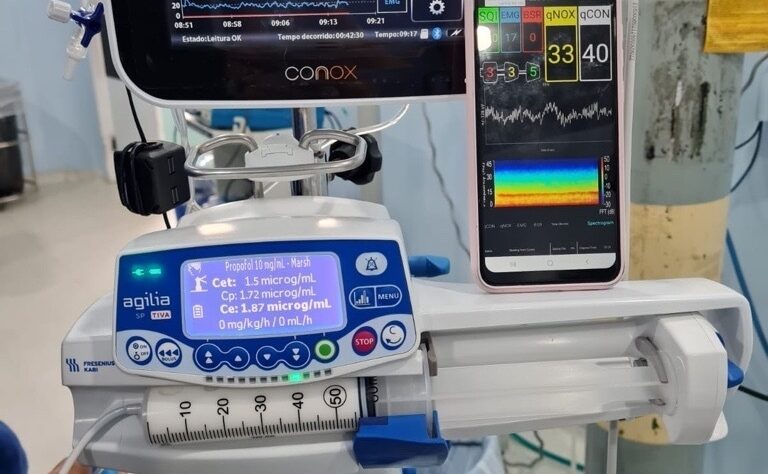 Chega ao Brasil novo aparelho de monitoramento de anestesia