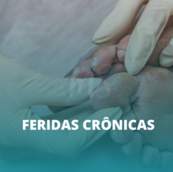 Estomaterapeuta trata ferida crônica e promove autocuidado eficaz