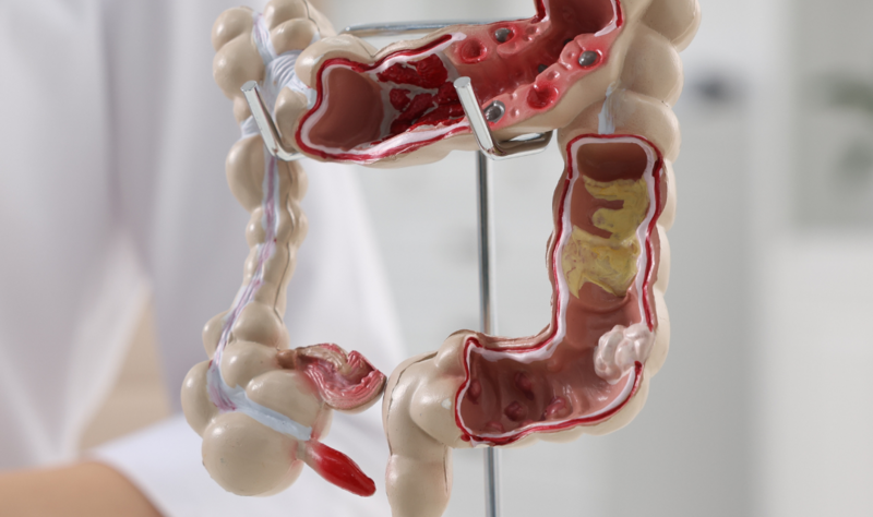 Adrian Bester lança curso on-line de modulação intestinal