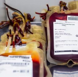 Brasil descarta doações de sangue por falhas de conservação e contaminação