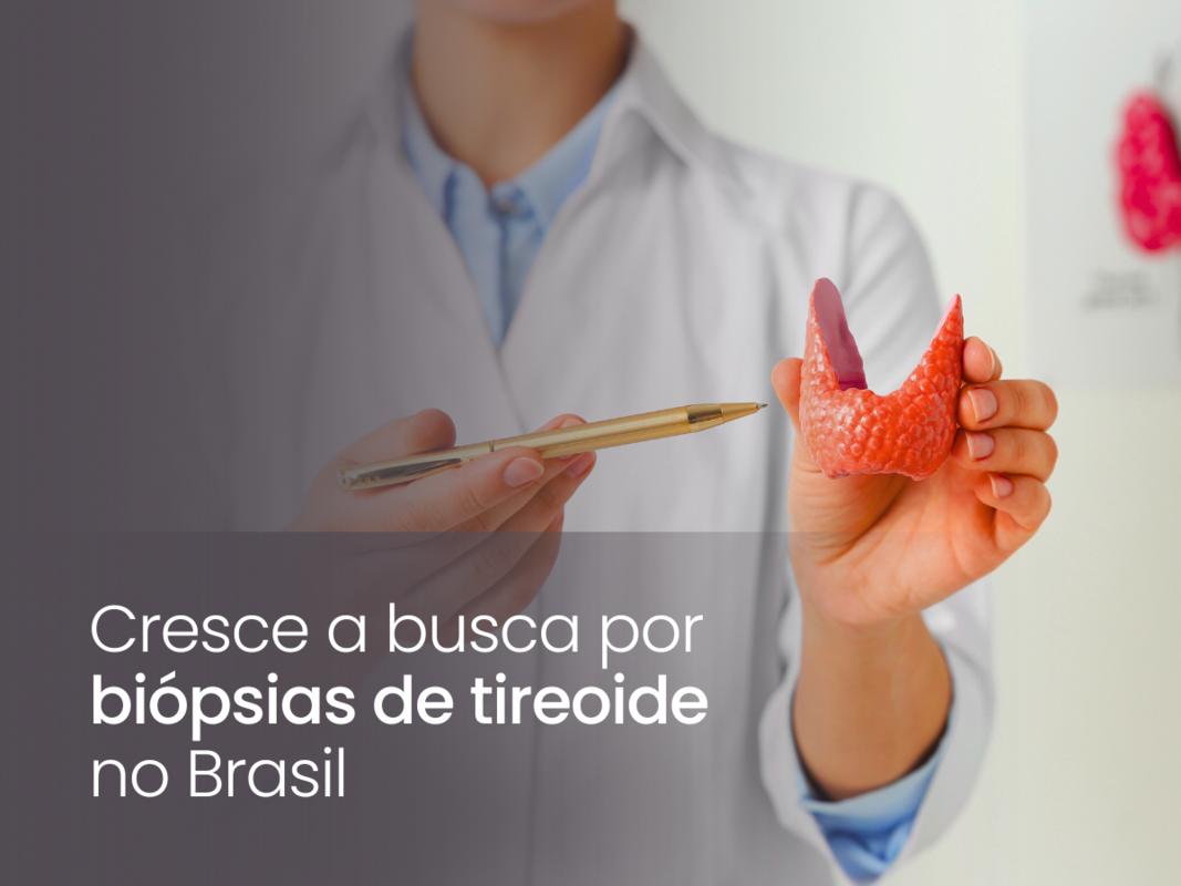 Cresce a busca por biópsias de tireoide no Brasil