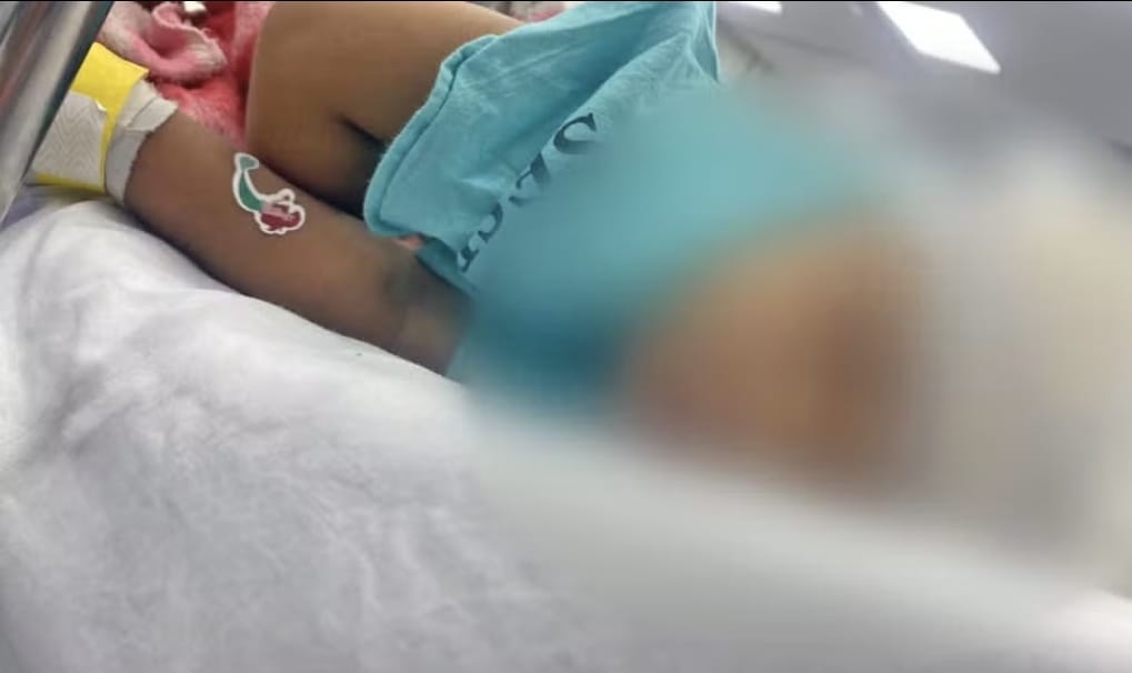 Bebê de 1 ano e 7 meses baleada na cabeça recebe alta após cirurgia no Hospital Municipalizado Adão Pereira Nunes, em Duque de Caxias.